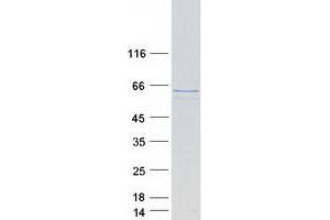 Validation with Western Blot