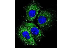 Confocal immunofluorescent analysis of CYBA Antibody (C-term) (ABIN656083 and ABIN2845428) with NCI- cell followed by Alexa Fluor 488-conjugated goat anti-rabbit lgG (green).