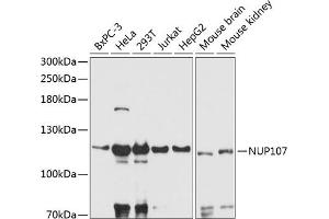 Western blot analysis of extracts of various cell lines, using NUP107 antibody (ABIN6129528, ABIN6144947, ABIN6144948 and ABIN6216980) at 1:3000 dilution. (NUP107 anticorps  (AA 766-925))