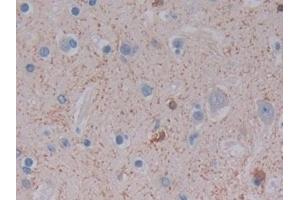 Detection of FTL in Human Cerebrum Tissue using Polyclonal Antibody to Ferritin, Light Polypeptide (FTL)