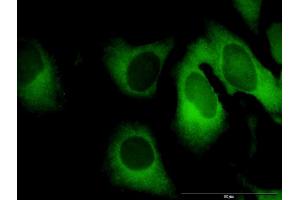 Immunofluorescence of purified MaxPab antibody to GBP1 on HeLa cell. (GBP1 anticorps  (AA 1-592))