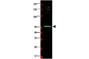 Image no. 1 for anti-RAD23 Homolog B (RAD23B) (AA 163-176) antibody (ABIN401177) (RAD23B anticorps  (AA 163-176))
