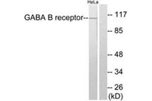 Western blot analysis of extracts from HeLa cells, using GABA-B Receptor Antibody. (GABBR1 anticorps  (AA 871-920))