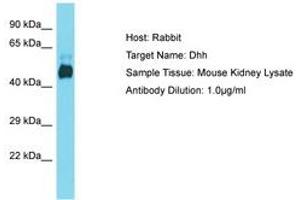 Image no. 1 for anti-Desert Hedgehog (DHH) (AA 74-123) antibody (ABIN6750459) (desert Hedgehog anticorps  (AA 74-123))