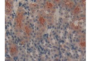 Detection of GAL9 in Mouse Kidney Tissue using Polyclonal Antibody to Galectin 9 (GAL9)