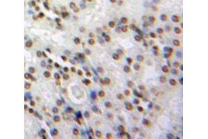 Used in DAB staining on fromalin fixed paraffin-embedded Kidney tissue (NMES1 anticorps  (AA 1-83))