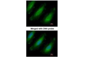 ICC/IF Image Immunofluorescence analysis of paraformaldehyde-fixed HeLa, using RPL13A, antibody at 1:200 dilution. (RPL13A anticorps)