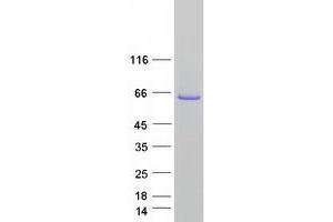 Validation with Western Blot