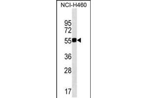 Western blot analysis in NCI-H460 cell line lysates (35ug/lane). (QRSL1 anticorps  (N-Term))