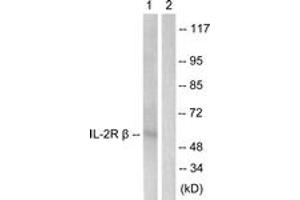 Western blot analysis of extracts from HepG2 cells, using IL-2R beta (Ab-364) Antibody. (IL2 Receptor beta anticorps  (AA 331-380))