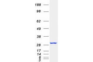 Validation with Western Blot