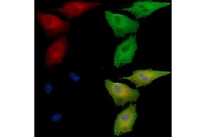 ABIN7096981 and ABIN7101048 staining  cells by IF/ICC.