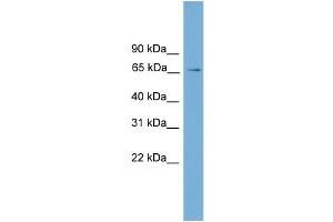 WB Suggested Anti-L3mbtl Antibody Titration:  0. (L3MBTL1 anticorps  (Middle Region))