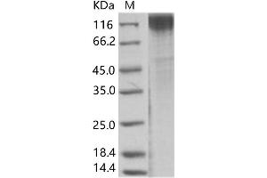 Western Blotting (WB) image for Simian Immunodeficiency Virus Surface Glycoprotein (SIV gp120) protein (His tag) (ABIN7198737)