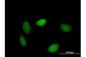 Immunofluorescence of purified MaxPab antibody to LSM1 on HeLa cell.