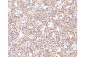 Immunohistochemistry of TEM4 in human spleen tissue with this product at 2.