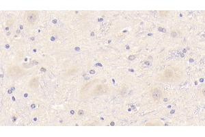 Detection of TREM2 in Mouse Cerebrum Tissue using Polyclonal Antibody to Triggering Receptor Expressed On Myeloid Cells 2 (TREM2)