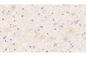Detection of TREM2 in Mouse Cerebrum Tissue using Polyclonal Antibody to Triggering Receptor Expressed On Myeloid Cells 2 (TREM2) (TREM2 anticorps  (AA 1-227))