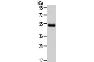 Western Blot analysis of Human placenta tissue using NR2F2 Polyclonal Antibody at dilution of 1/200 (NR2F2 anticorps)