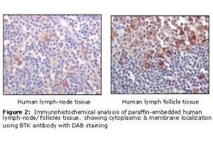 Image no. 1 for anti-Bruton Agammaglobulinemia tyrosine Kinase (BTK) antibody (ABIN232137) (BTK anticorps)