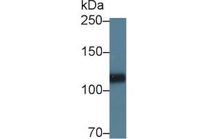 Western blot analysis of Pig Heart lysate, using Human HSPG2 Antibody (5 µg/ml) and HRP-conjugated Goat Anti-Rabbit antibody ( (HSPG2 anticorps  (AA 4149-4391))