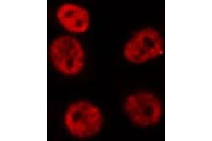 ABIN6276949 staining HepG2? (HOXA9 anticorps  (Internal Region))