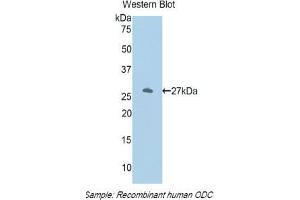 Western blot analysis of the recombinant protein. (ODC1 anticorps  (AA 234-453))