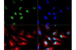 Immunofluorescence of Rabbit Histone H3 pT3/R2Me2s. (Histone 3 anticorps  (H3R2me2s, pThr3))