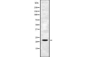 Western blot analysis FGF6 using HuvEc whole cell lysates (FGF6 anticorps  (N-Term))