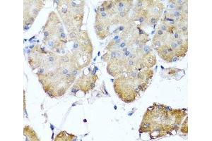 Immunohistochemistry of paraffin-embedded Human stomach using NIN Polyclonal Antibody at dilution of 1:100 (40x lens).