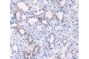 Used in DAB staining on fromalin fixed paraffin- embedded Kidney tissue
