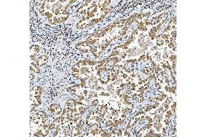 IHC analysis of TRIR using anti-TRIR antibody (ABIN7603244). (Uncharacterized Protein C19orf43 (TRIR) (N-Term) anticorps)