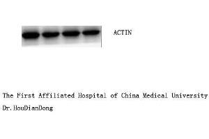 Western Blot (WB) analysis: Please contact us for more details. (beta Actin anticorps  (N-Term))
