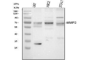anti-Matrix Metalloproteinase 2 (MMP2) (AA 429-660) antibody