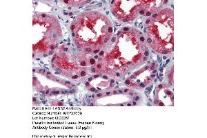 Immunohistochemistry with Human kidney lysate tissue at an antibody concentration of 5. (Ceramide Synthase 2 anticorps  (N-Term))