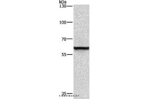 Western blot analysis of A431 cell, using TRIP4 Polyclonal Antibody at dilution of 1:400 (TRIP4 anticorps)