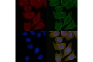 ABIN6258970 and ABIN6275382 staining Hela cells(30 min of UV treatment) by IF/ICC.
