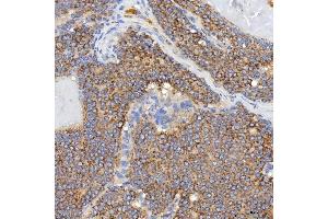 IHC analysis of SGCE using anti-SGCE antibody (ABIN7601544). (SGCE anticorps  (AA 38-407))