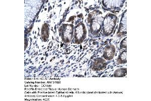 Rabbit Anti-HCLS1 Antibody  Paraffin Embedded Tissue: Human Stomach Cellular Data: Epithelial cells of Fundic Gland Antibody Concentration: 4. (HCLS1 anticorps  (N-Term))