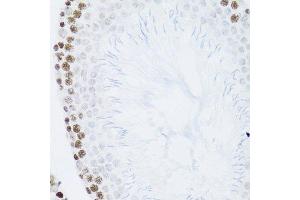 Immunohistochemistry of paraffin-embedded mouse testis using NFKB2 Antibody.