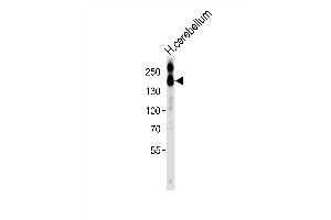Western blot analysis of lysate from HT-1080 cell line, using NC Antibody (C-term) (ABIN6242237 and ABIN6577689).