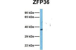 Host:  Rabbit  Target Name:  ZFP36  Sample Tissue:  Human Fetal Liver  Antibody Dilution:  1. (ZFP36 anticorps  (N-Term))