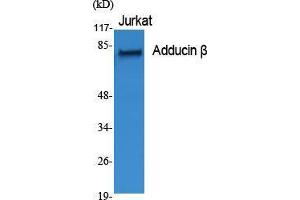 Western Blot (WB) analysis of specific cells using Adducin beta Polyclonal Antibody.