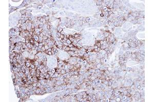 anti-Intestinal Alkaline Phosphatase (ALPI) antibody