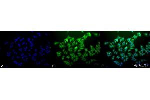 Immunocytochemistry/Immunofluorescence analysis using Mouse Anti-Ubiquitin Monoclonal Antibody, Clone 6C11-B3 . (Ubiquitin anticorps  (Atto 390))