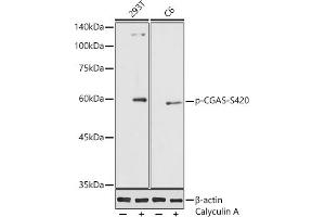Western blot analysis of extracts of various cell lines, using Phospho-CGAS-S420 antibody (ABIN7266387) at 1:1000 dilution. (C6orf150 anticorps  (pSer420))