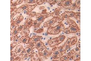 Used in DAB staining on fromalin fixed paraffin- embedded liver tissue (ABCA8 anticorps  (AA 1263-1456))