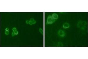 Immunofluorescence analysis of Hela (Left) and MCF-7 (Right) cells using Tyro3 antibody (green). (TYRO3 anticorps  (AA 138-321))