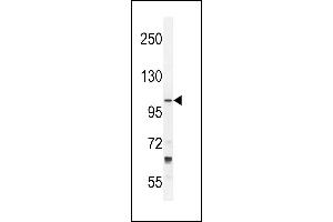 TLL2 Antibody (N-term) (ABIN392519 and ABIN2842079) western blot analysis in NCI- cell line lysates (35 μg/lane).