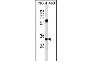 SDCBP Antibody (N-term) (ABIN1881779 and ABIN2838949) western blot analysis in NCI- cell line lysates (35 μg/lane). (SDCBP anticorps  (N-Term))